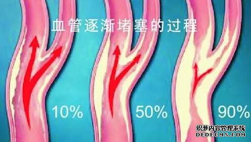 揭露“三高”真相：高血壓、高血脂、高血糖
