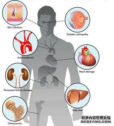 年過四十，把健身納入日?；顒佑绕渲匾赡苡绊懩暮蟀肷?。