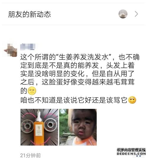 防脫干貨，真實經歷分享！如何戰(zhàn)勝脫發(fā)，本文總結多種方法