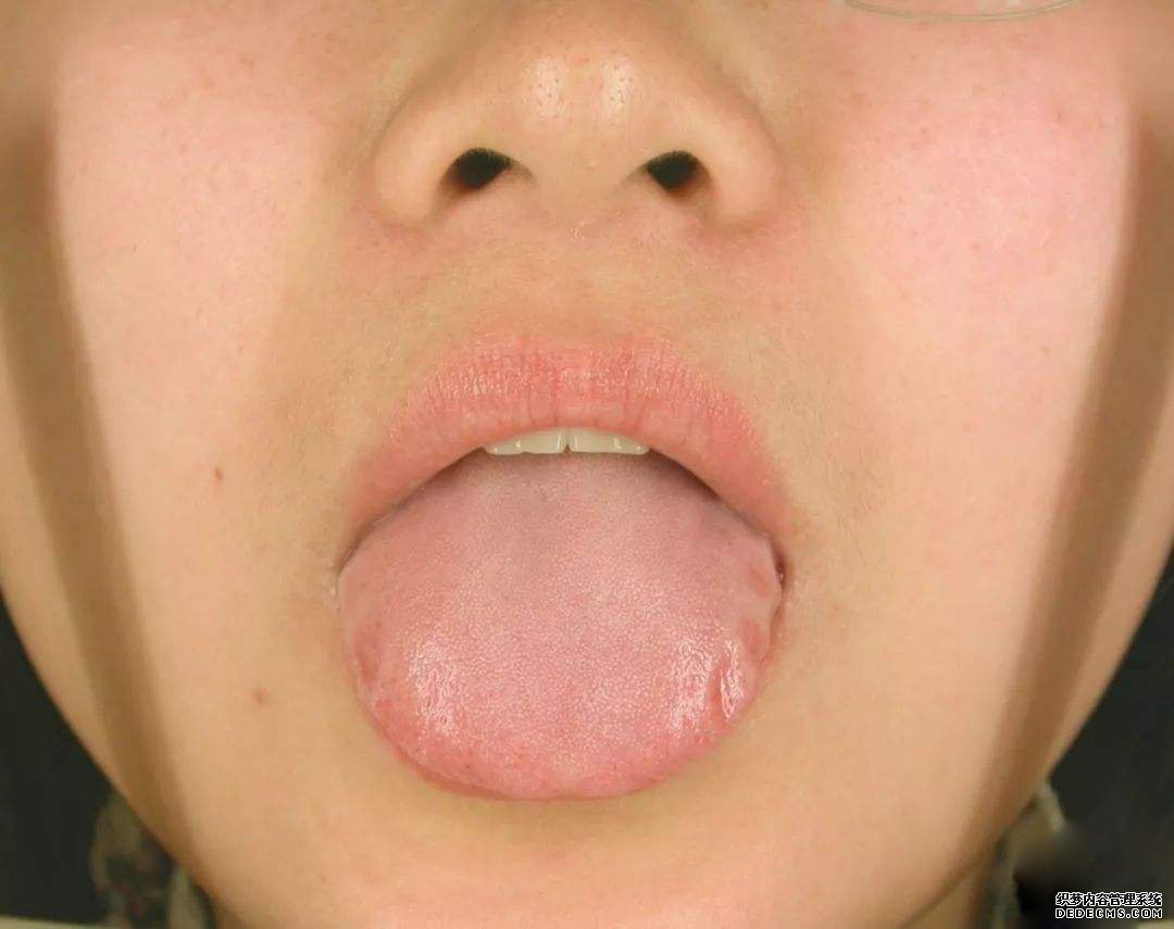 看舌頭，知全身？自己是什么體質(zhì)，體內(nèi)是否有疾，伸舌一看便知