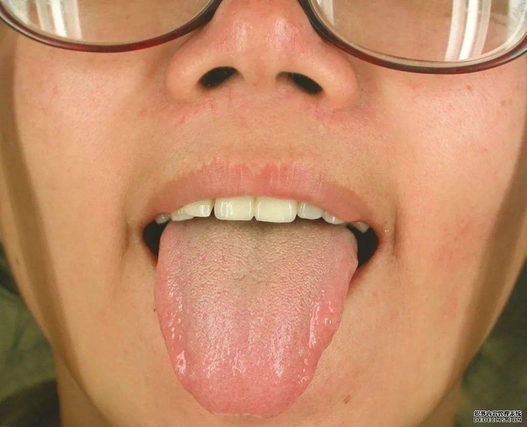 看舌頭，知全身？自己是什么體質(zhì)，體內(nèi)是否有疾，伸舌一看便知