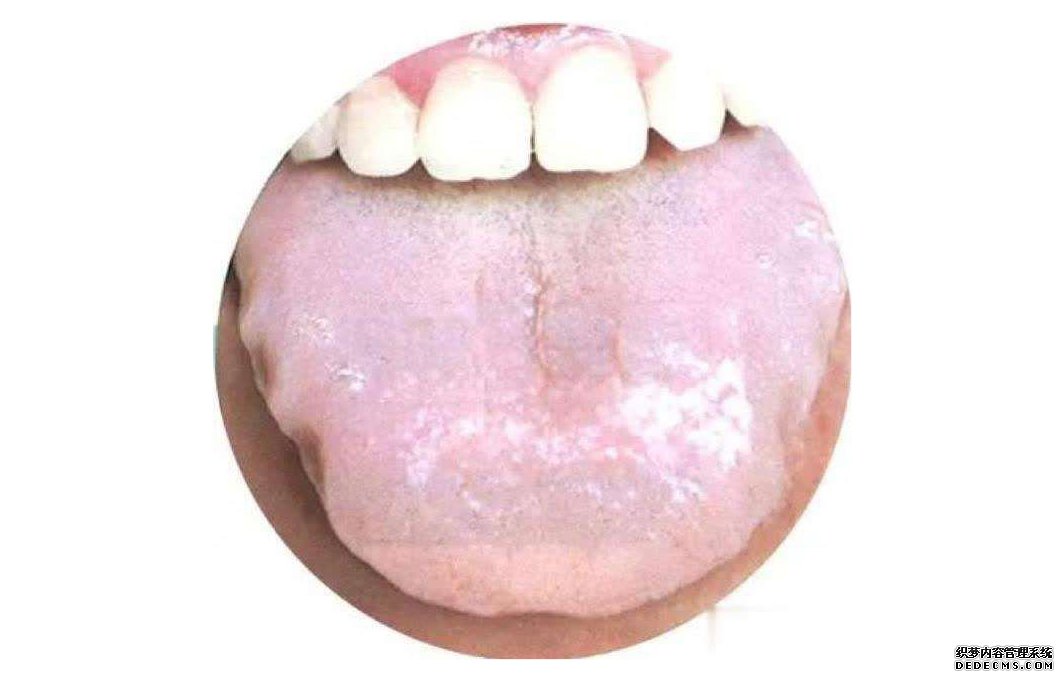 看舌頭，知全身？自己是什么體質(zhì)，體內(nèi)是否有疾，伸舌一看便知