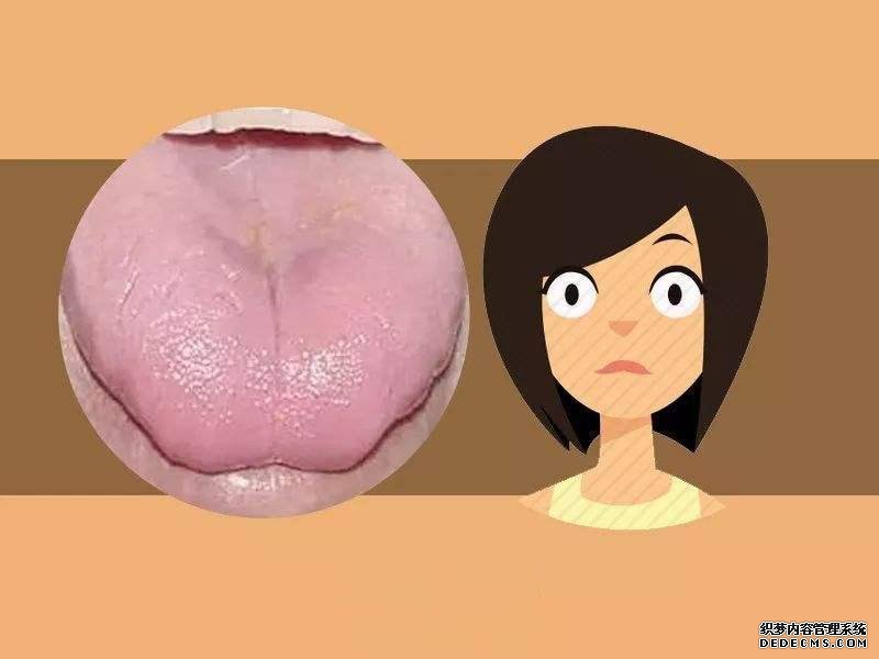 看舌頭，知全身？自己是什么體質(zhì)，體內(nèi)是否有疾，伸舌一看便知